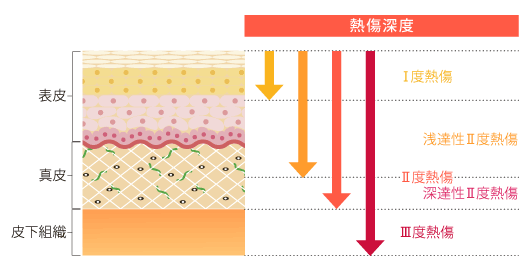 熱傷深度