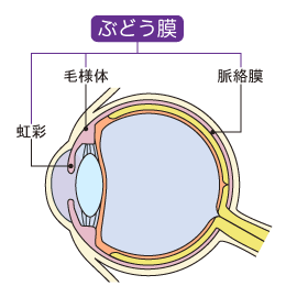 ぶどう膜炎