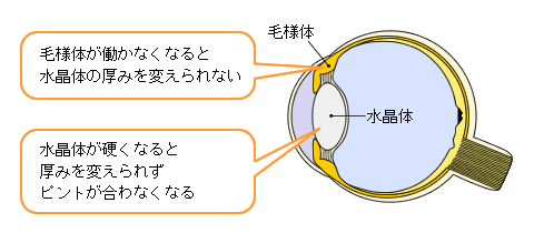 老眼のしくみ