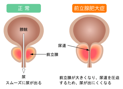 前立腺のしくみ