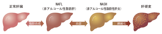 肝臓の変化