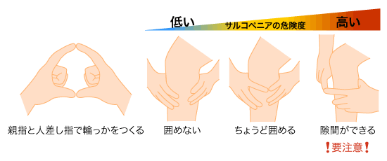 サルコペニアチェック“指輪っかテスト”