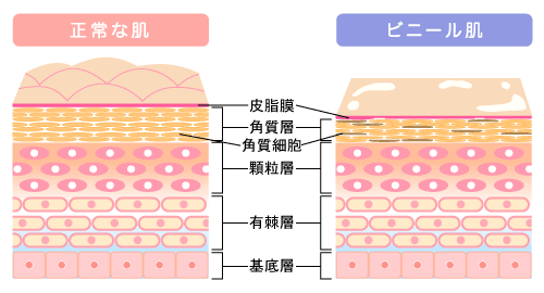 正常な肌とビニール肌