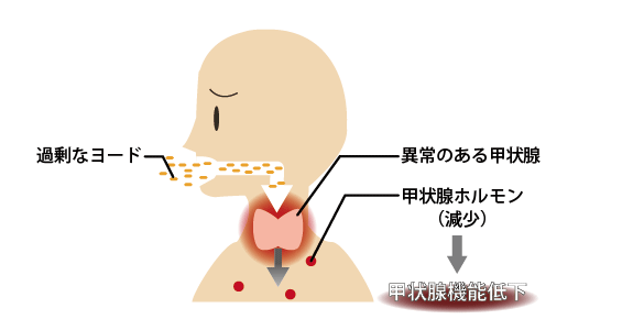 過剰症