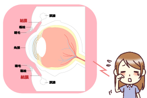 アレルギー性結膜炎　目のかゆみ　充血　涙がでる